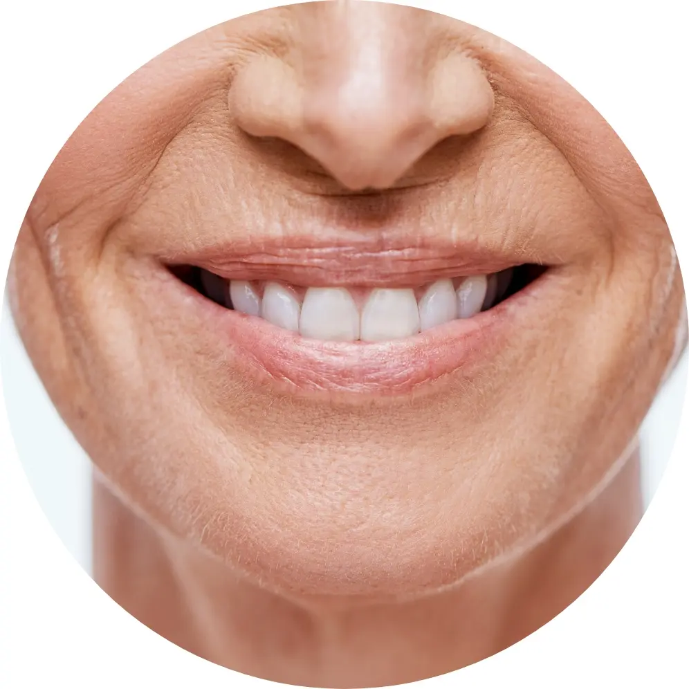 Prophylaxe Grinsender Mund